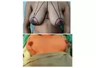 Get The Best Treatment For Gynaecomastia