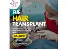 Hair Transplant Service in Chandigarh
