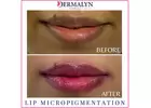 Lips Micropigmentation in Delhi