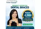 Best Teeth Braces Treatment in Kondapur | Asian Dental