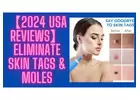 Full Body Skin Tag Remover Straight Sale - [US] For Smooth & Tag-Free Skin!