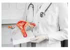 Uterine Artery Embolization Treatment Delhi