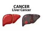 Best Liver Cancer Treatment Hospital in Delhi | Action Cancer Hospital