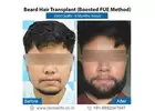What kind of Anesthesia is used during Beard Hair Transplants?