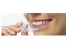 Maintaining Oral Hygiene with Invisalign in Preston: Tips for Success